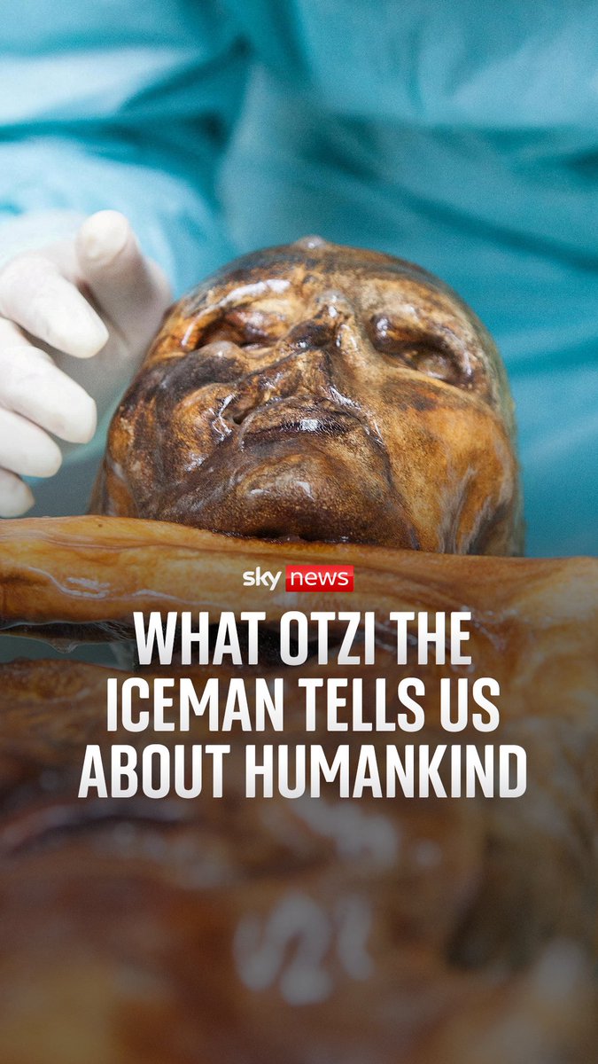 What does Europe’s oldest natural mummy tell us about humankind? A mummy researcher tells Yalda Hakim about how his colleagues discovered the active microbes on Otzi The Iceman's body