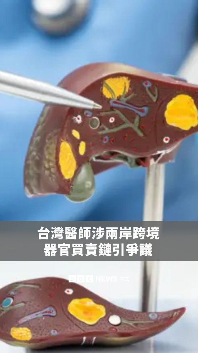 台湾一宗非法器官移植案件,揭露两岸近20年来持续不断的跨境器官买卖链。 案件涉及台湾肝脏名医陈尧俐与中国多名医疗人员合作,长期仲介台湾病患到中国医院接受器官移植,他从中获利上千万元新台币的仲介费。 11名台湾病患经陈尧俐仲介,曾有个案支付高达1400万元新台币费用(301万人民币;44.6万美元),结果手术后仅存活9天,另有病患在手术后当场死亡。 陈尧俐被台湾法院裁定违反《人体器官移植条例》判缓刑、没收仲介费,近日再被废除医师证书。 中国法例也明文禁止他人出卖人体器官,但公开资料未见调查或检控涉案中国医疗人员。
