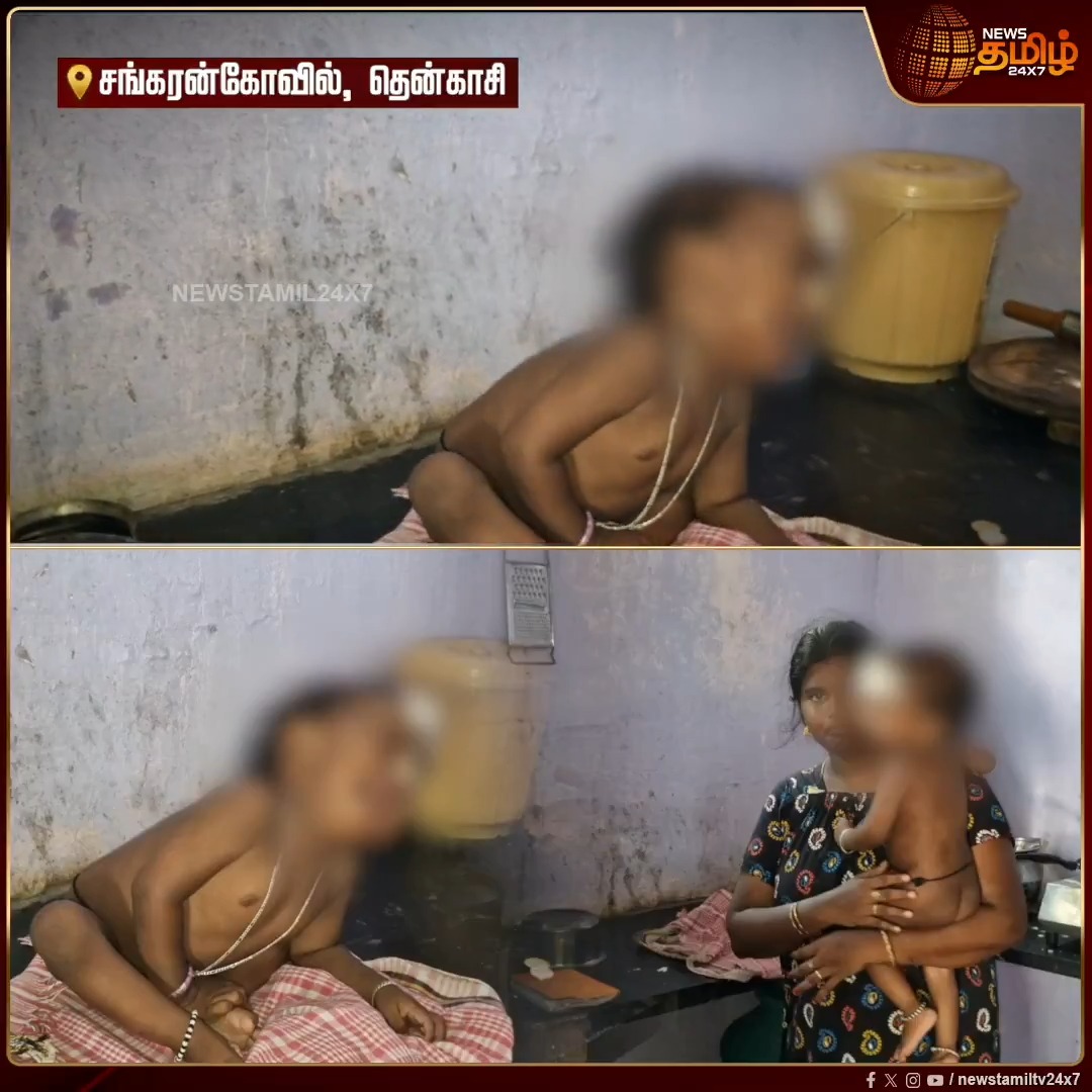 உணவுக்குழாயும், மூச்சுக் குழாயும் இணைந்திருப்பதால் பிறந்து இரண்டு வருடங்கள் ஆகியும் தாய்ப்பாலின் மனம் சுவை தெறியாமல் பரிதவிக்கும் குழந்தை; அறுவை சிகிச்சை செய்ய பணமின்றி தவிக்கும் பெற்றோர் அரசுக்கு வைத்த கோரிக்கை #Tenkasi #Baby #parents #Esophagus #TNGovt #NewsTamil24x7