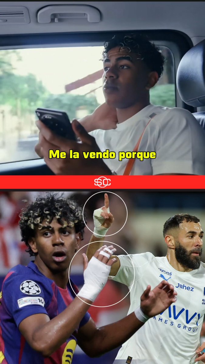 Lamine Yamal y el motivo por el que usa vendaje en su mano... ¡con Karim Benzema como inspiración! 📹 YT/LamineYamal
