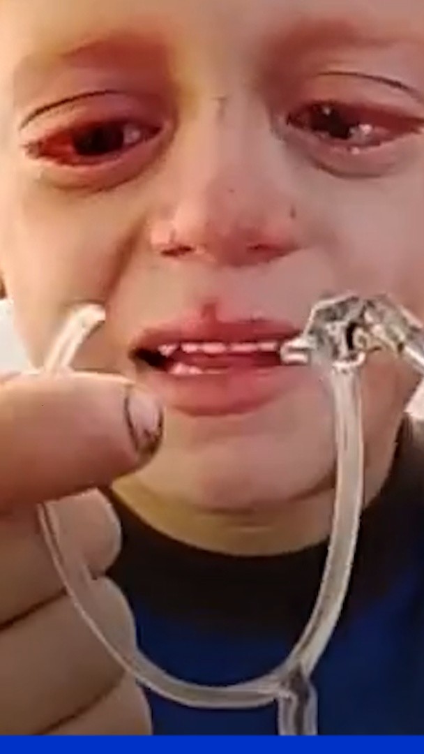 Ce jeune garçon gazaoui pleure ses lunettes cassées, une cagnotte est créée pour l’aider