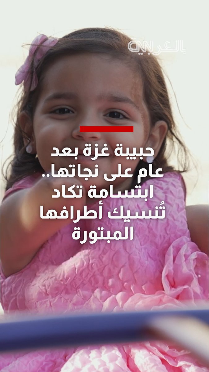 حبيبة غزة بعد عام على نجاتها من الموت.. ابتسامة تكاد تُنسيك أطرافها الثلاثة المبتورة
