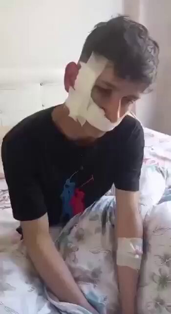 🟣DEM Milletvekili Öznur Bartın: "Hakkari’de 17 yaşındaki S. Hazar'ın, uzman çavuşun da bulunduğu bir grup tarafından silah kabzasıyla darbedildi" (Kaynak: Rudaw Türkçe)