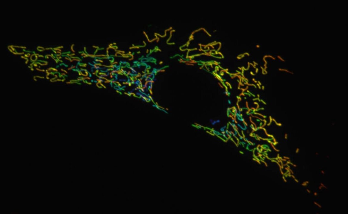 Mitochondria in a living cell, imaged today while I was training new lab members on our spinning-disk confocal microscope. Shown are the full cell and zoomed-in regions of interest. Total imaging time: 60 minutes. #CellBiology