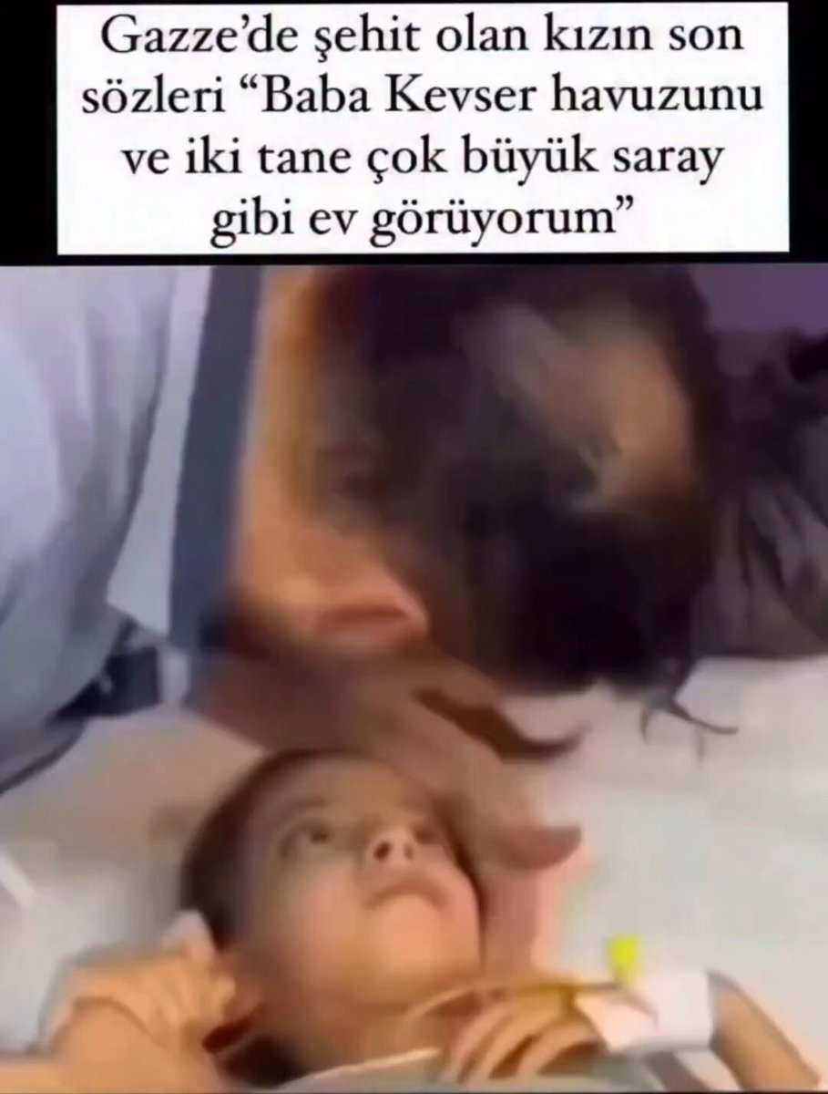 Gazze bize bir mucize daha gösterdi... K*til isr*ilin şehit ettiği kız, sabit bakışlarıyla kendisine gösterilen makamı sonrası son nefesini veriyor ama o anlar saniye saniye kaydediliyor. Gücü yetip de sessiz kalanlar, kendi sonlarını düşünsün !!! #GazzedeZulümArşaDayandı