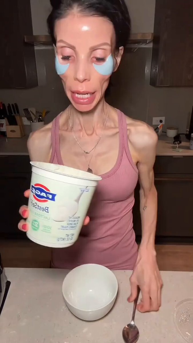 If anorexia had a face: 😳