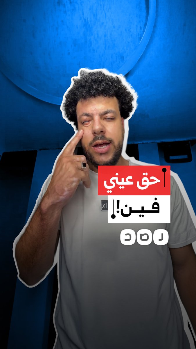 مواطن يستغيث بعد تعرضه لإصابة خطيرة بالعمل في محافظة الشرقية