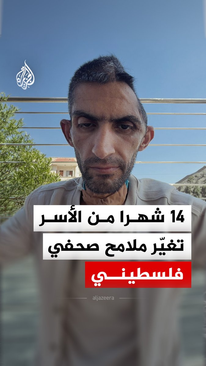 بعد فقدان جزء من جمجمته.. صورة صادمة للصحفي الفلسطيني مجاهد بني مفلح عقب خروجه من سجون الاحتلال بعد اعتقال دام 14 شهرا، تحدث فيها عن معاناته في الأسر ورحلة تعافيه الطويلة #الجزيرة_رقمي