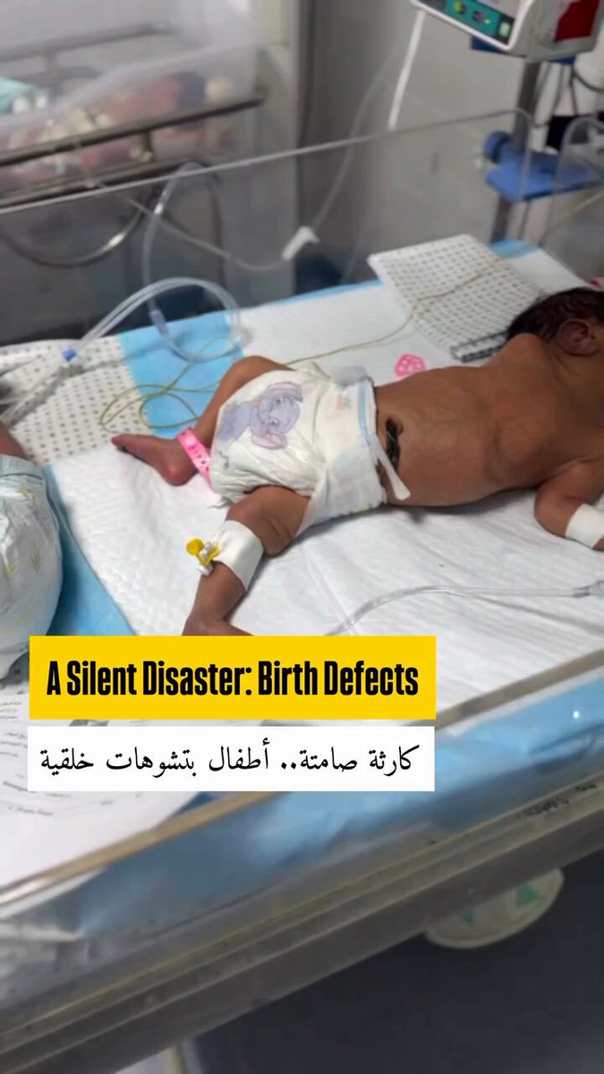 Successive medical warnings of a long-term health catastrophe in the Gaza Strip, with a notable increase in fetal deformities and miscarriages resulting from the harsh conditions of war.