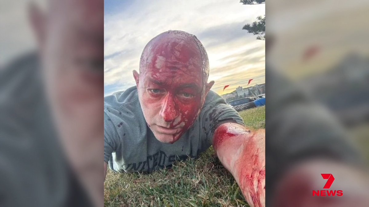 A survivor of the Bondi beach terror attack has revealed how he's become a victim all over again. Arsen Ostrovsky has told the Royal Commission on antisemitism, he's been repeatedly attacked online - and wants social media companies to live up to their social responsibility.