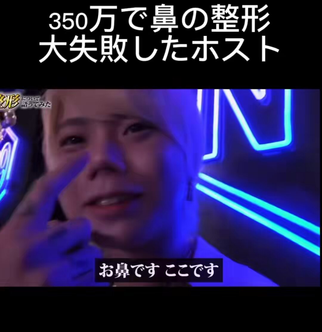 家族には120%の自信を持って勧められない美容外科の隠語がこれ🏥 人中の壊し屋 グレ🪑 とあーる 🍇 鼻の壊し屋 ピタNG 🐧 🏝️クリ 👮‍♀️🏥 過剰脱脂モンスター 東京真ん中 一塁手 品◯ beerンカ 前🏥 ザ🌰 ZE⭐️ ザ＋ グローバルな病院 エム&エムズ 李儒 フェイス＋ 自称鼻整形のプロ（皮膚科上がり） ザ6 😬 Fe ⛰️脇 🪡 🐚 🌏 眉下切開一択老害 🪽 直美暖簾分け ハイブリッド豊胸🌸 エモい 🐉 直美女医、🪨川先生 デis 🐟 銀座ビ🥫 クーヘン 埋没ホスト りNO アス🐯 ベリND