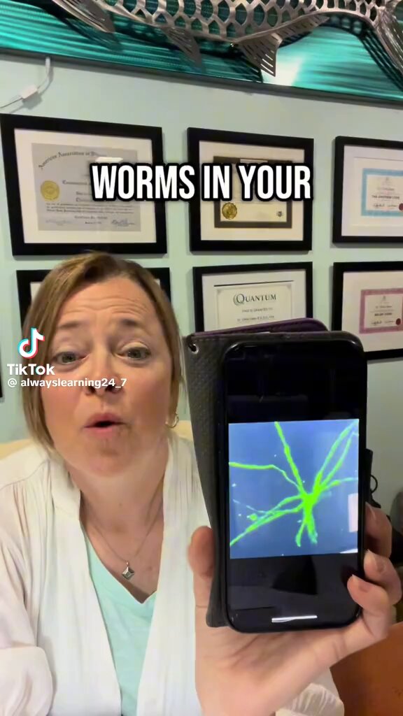 MS is worms in your brain. 🪱 🧠