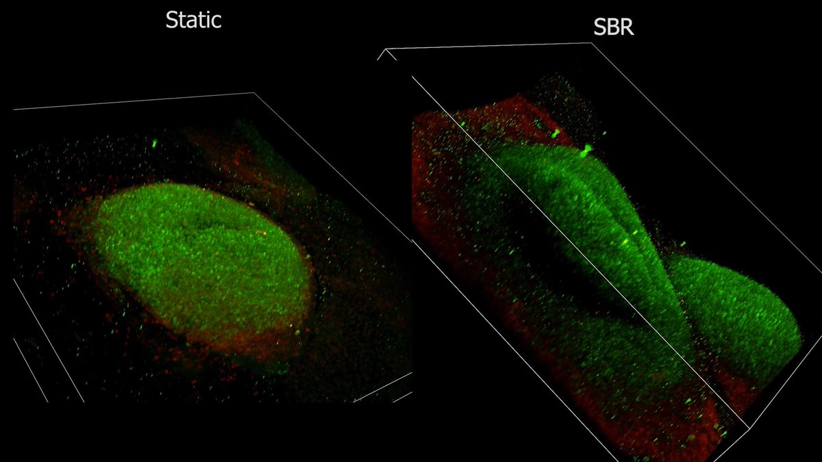 NIH scientists found that retinal organoids, lab-grown models of the human retina, often don't get enough oxygen during early development. To solve this problem, they created a simple 3D-printed stirred bioreactor that keeps oxygen levels in a healthy range. The result: larger, healthier retinal organoids with improved survival and more consistent growth. This low-cost, easy-to-use tool could help researchers create better models to study blinding diseases and test potential treatments. Read more:
