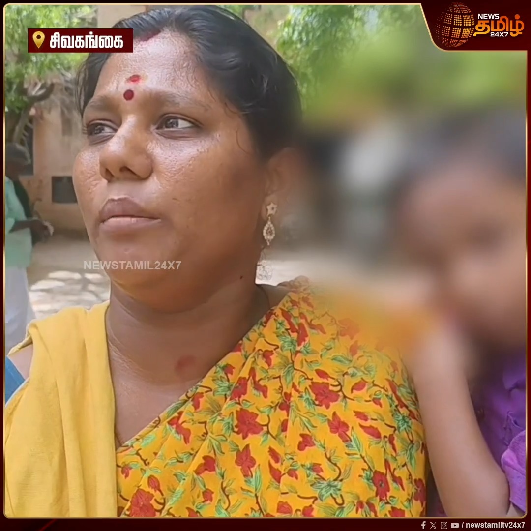 மூக்கில் ஏற்பட்ட வீக்கம், பரிசோதனை செய்யாமல் உயர் சிகிச்சைக்கு பரிந்துரைத்த ஆரம்ப சுகாதார நிலைய மருத்துவர்கள்.. மூக்கில் சிக்கிய பாசியை அகற்றி 3 வயது பிஞ்சுக்குழந்தையை காப்பாற்றிய தனியார் கிளீனிக்! #NewsTamil24x7 #ChildSafety #TamilNadu #PrivateClinic