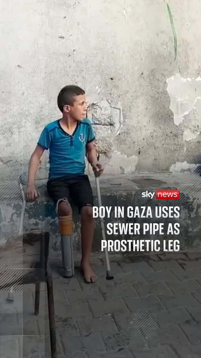A piece of sewer pipe found in the street has been acting as a prosthetic leg for 10-year-old Rateb since he lost the limb in an Israeli strike. Rateb, a 10-year-old from Gaza, lost his leg, his mother and his brother during Israeli bombardment.