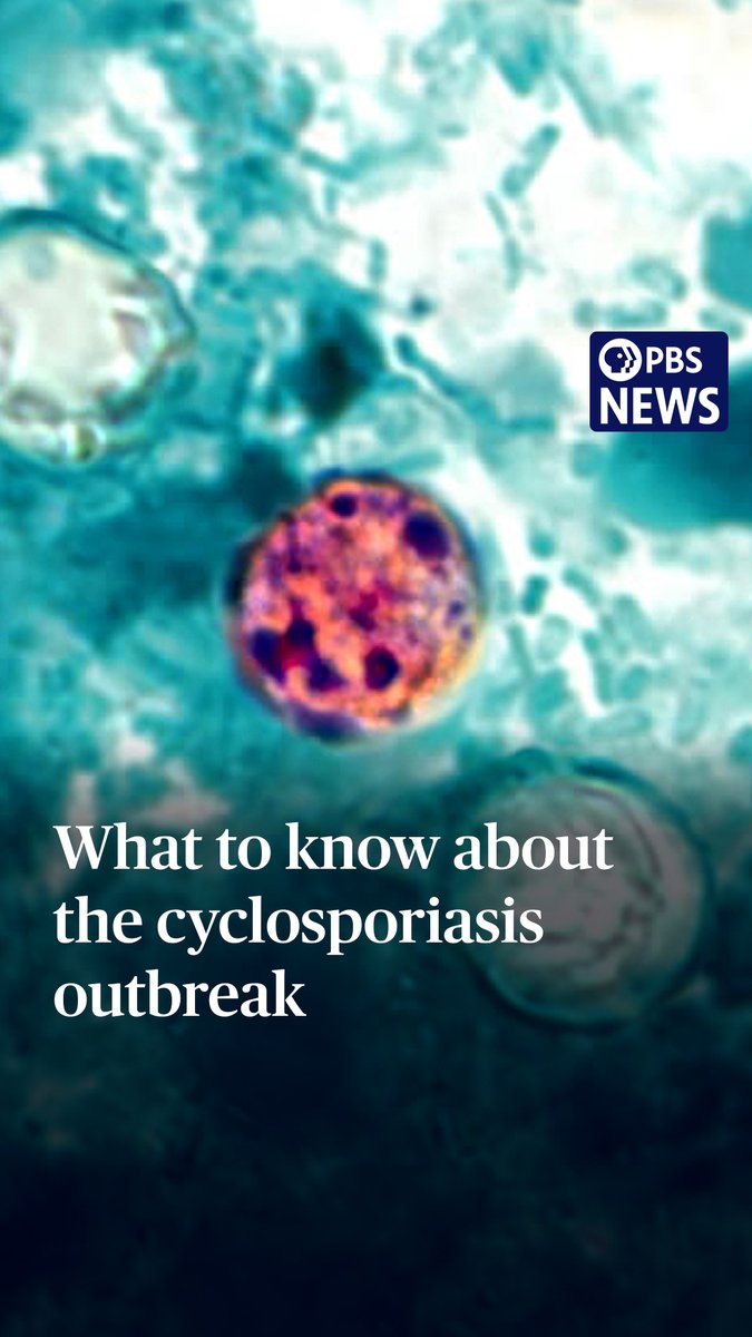 A cyclosporiasis outbreak has now affected more than 1,700 people and counting. More than two dozen states are investigating cases of the foodborne parasitic infection. While it’s not fatal, symptoms can include “frequent and sometimes explosive bowel movements,” according to the Centers for Disease Control and Prevention. The source of the outbreak is unknown; the cyclospora cayetanensis parasite can be hard to track as it can’t be reproduced in a lab and it is not always detected through food poisoning tests. The CDC made state reporting of the infections optional when it scaled back its Foodborne Diseases Active Surveillance Network. PBS News’ Tim McPhillips explains what cyclosporiasis is, how it spreads and how to avoid illness.