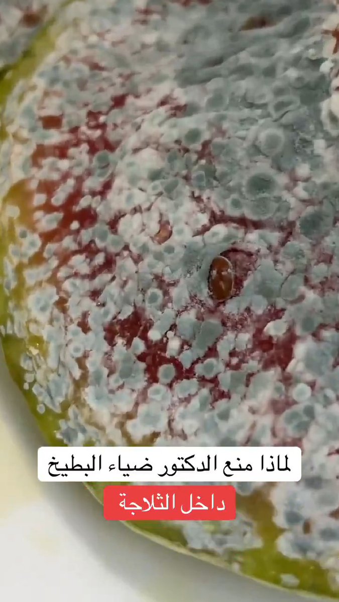 لهذا السبب منع الدكتور ضياء منع البطيخ 🤯