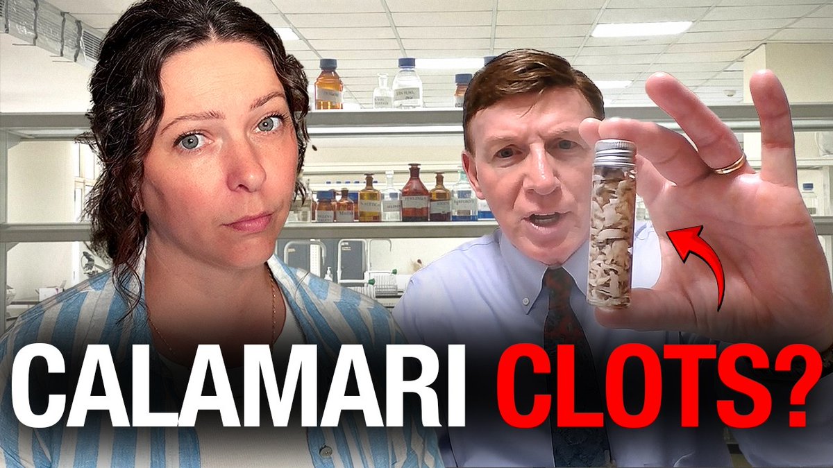 What are these 'calamari-like' clots that embalmers keep finding? New peer-reviewed paper examines the recent phenomena of unusual white fibrous clots found by embalmers. Retired Air Force Major Thomas Haviland’s peer-reviewed research exposes a persistent phenomenon that the mainstream medical establishment continues to ignore. A new peer-reviewed paper published July 1 in the International Journal of Innovative Research and Medical Science breaks down what embalmers across English-speaking countries have discovered in recent years: tough, rubbery, white fibrous clots appearing in a significant percentage of bodies long after the COVID-19 pandemic and vaccine rollout. Thomas Haviland, a retired U.S. Air Force Major, began investigating this phenomenon after watching the 2022 documentary Died Suddenly. He has since conducted annual surveys of embalmers in the United States, Canada, the UK, Australia, and New Zealand. His latest analysis of 808 responses from 2022 through 2025 found that 75% of embalmers reported seeing the unusual clots. “The embalmers are seeing these white fibrous clots in an average of 23% of their corpses,” Haviland stated. A separate, more recent, 2026 survey of Tennessee embalmers showed roughly 70% still observing the clots in 18% of cases, according to Haviland. Notably, these structures differ sharply from clots seen before 2020. “Many of these embalmers have 20 or 30 years of experience, never saw this phenomenon before,” Haviland explained. “Prior to COVID, they would see two types of clots. What’s called grape jelly clots… And they also see what’s called chicken fat clots… Much, much different than these large white fibrous clots, which are really tough and rubbery and hard to break." Haviland also shared the account of an endovascular specialist and cardiologist in Jacksonville, Florida, who contacted him about removing similar clots from living patients at his lab. “He actually refers to the clots as devious clots,” Haviland said. After sharing images and angiograms, the doctor emailed in March 2024 to tell Tom that he had been instructed to terminate communication immediately. “Somebody, his hospital administrator probably got to him, right? Told him to shut up, stop talking about this, or else we’ll go after your medical license,” Haviland observed. “So it’s a shame. That’s what’s happening. People are staying silent about this when they should be speaking out.” Laboratory tests on the clots, including Raman spectroscopy and others, point to the spike protein — whether from the virus, modified RNA injections, or both — sticking to a blood protein called fibrinogen and creating unusual structures. “It makes that fibrinogen all misfolded and twisted… So then it becomes almost impossible to break down the clot. It becomes this rubbery polymer instead,” Haviland said. Despite repeated submissions of survey results to the FDA, CDC, and NIH, and the publication of supporting papers, major health agencies and institutions including the Mayo Clinic, Cleveland Clinic, Johns Hopkins, and Stanford have shown no interest in obtaining samples for further study. Although Haviland’s initial preprint was rejected by one platform as “not novel enough,” four years later, embalmers continue to report the never-before-seen clots into 2026. Haviland and others behind his research are calling for forensic pathologists and independent researchers to examine the structures directly and for congressional hearings to investigate what embalmers have been documenting for years.