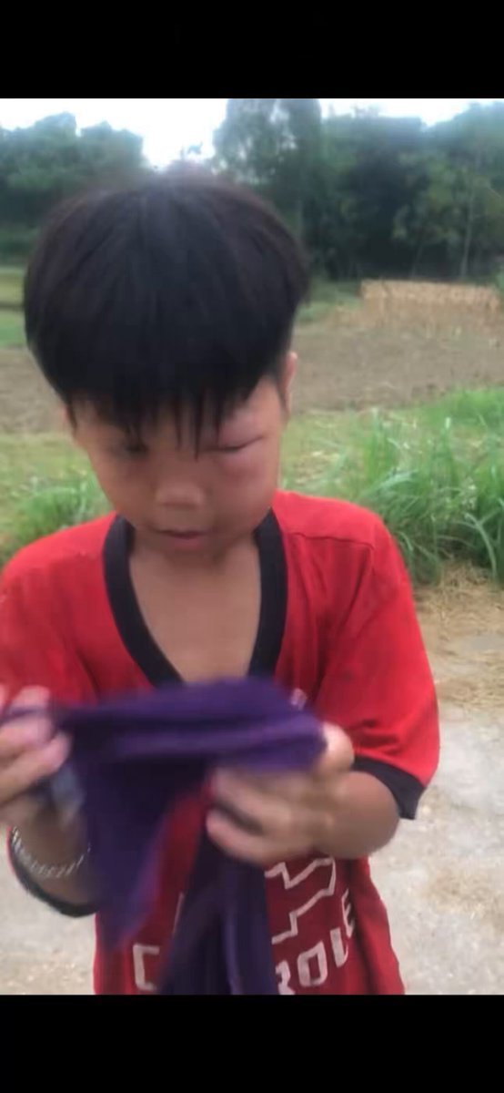 Khổ thân cu cháu , ai bảo thích chêu ong 🤣🤣🤣
