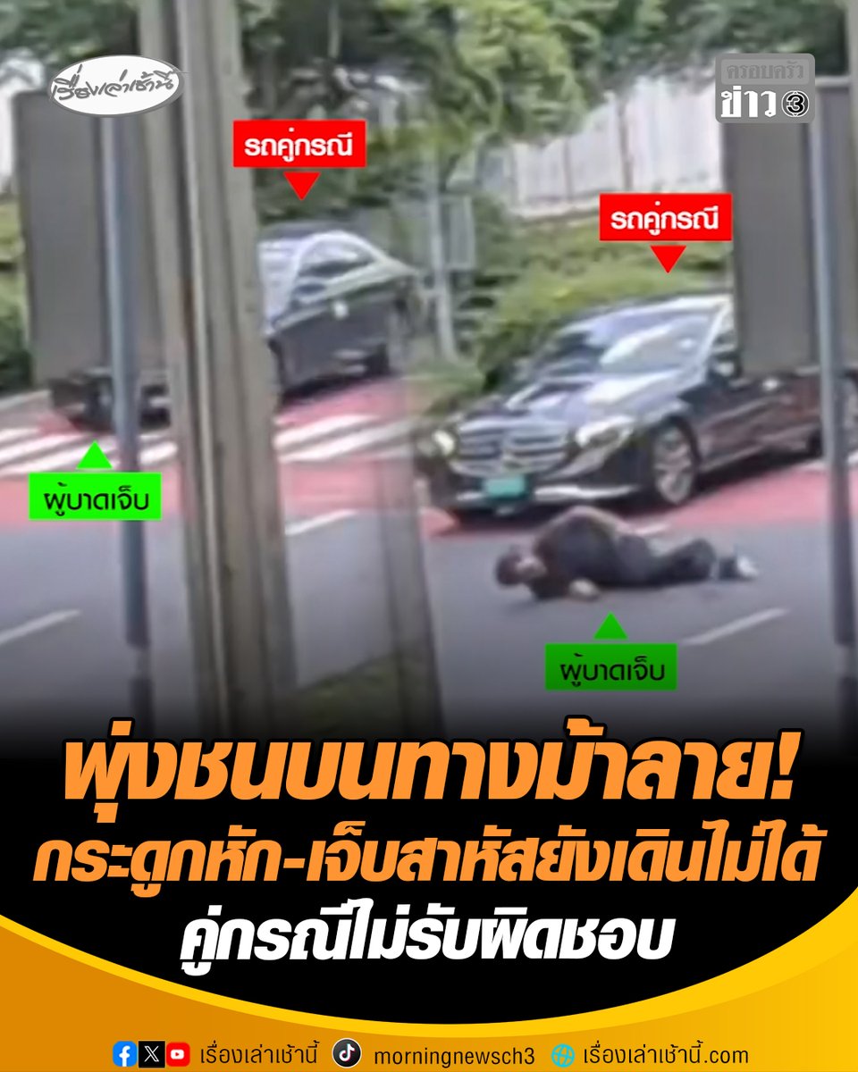 ขอความเป็นธรรม! หนุ่มถูกเก๋งพุ่งชนขณะเดินข้ามทางม้าลาย เจ็บสาหัส กระดูกสะโพกและแขนหัก ต้องรักษาที่โรงพยาบาลนาน 12 วัน จนถึงตอนนี้ยังไม่สามารถเดินได้ ทำงานก็ไม่ได้ ขาดรายได้เลี้ยงดูครอบครัว ไร้การติดต่อช่วยเหลือจากคู่กรณี #เรื่องเล่าเช้านี้ #ครอบครัวข่าว3 #ชนทางม้าลาย #ถนนเจริญราษฎร์