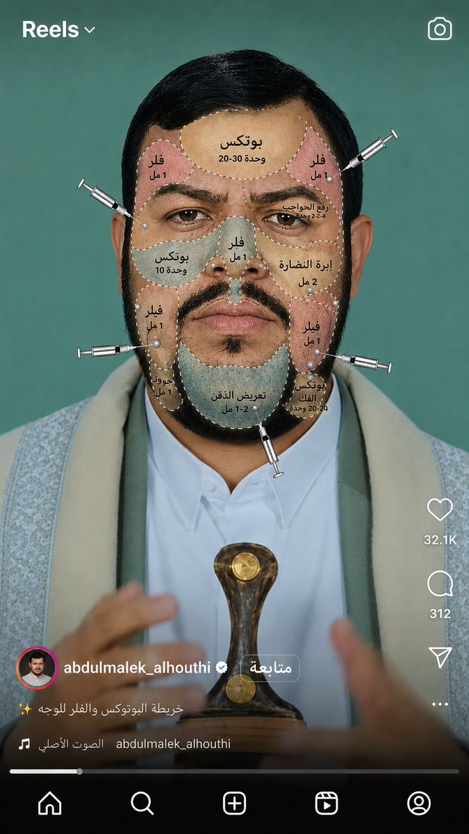 ظهر عبدالملك الحوثي اليوم يهدد بوجه مليء بالبوتكس، وجبهة محشوة بالسلكون، وخدود وردية .. ماذا أبقيت للنساء يا خادم إيران ؟! #الحوثي_خادم_ايران_الفارسيه