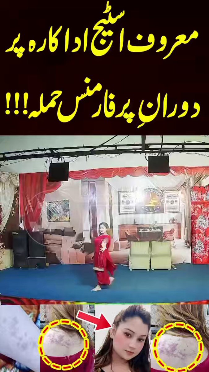 ایسی گھٹیا پرفارمنس کا یہی بہترین علاج ہے 👇😂