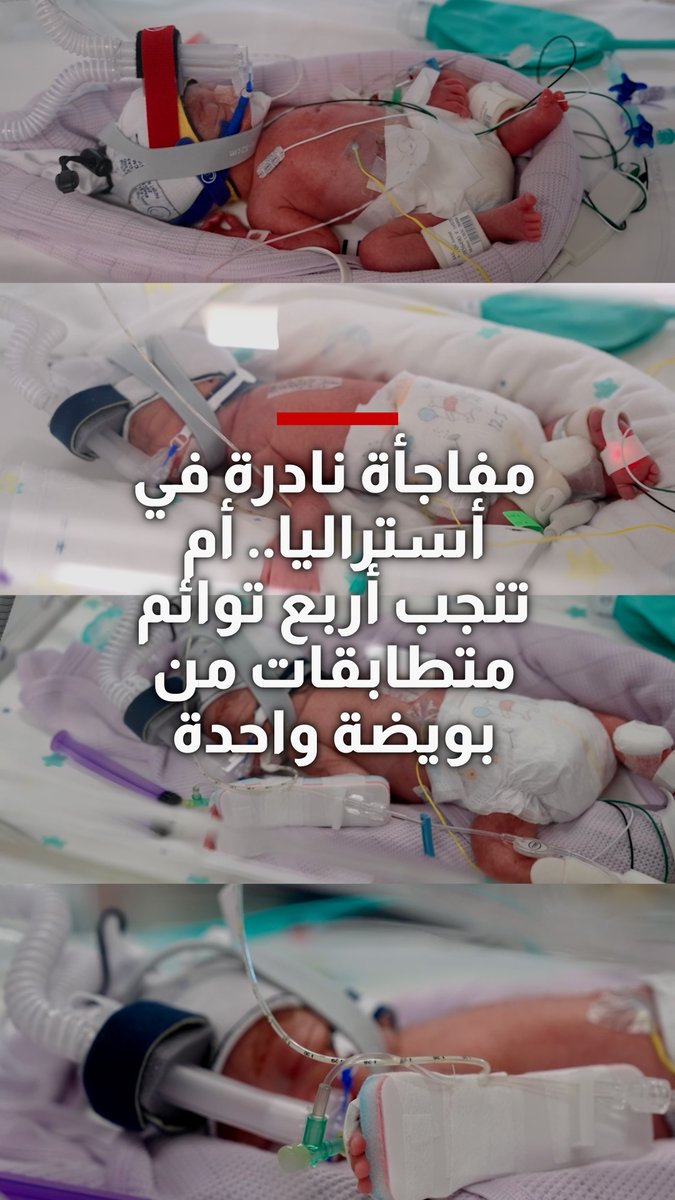 مفاجأة نادرة في أستراليا.. أم تنجب أربع توائم متطابقات من بويضة واحدة