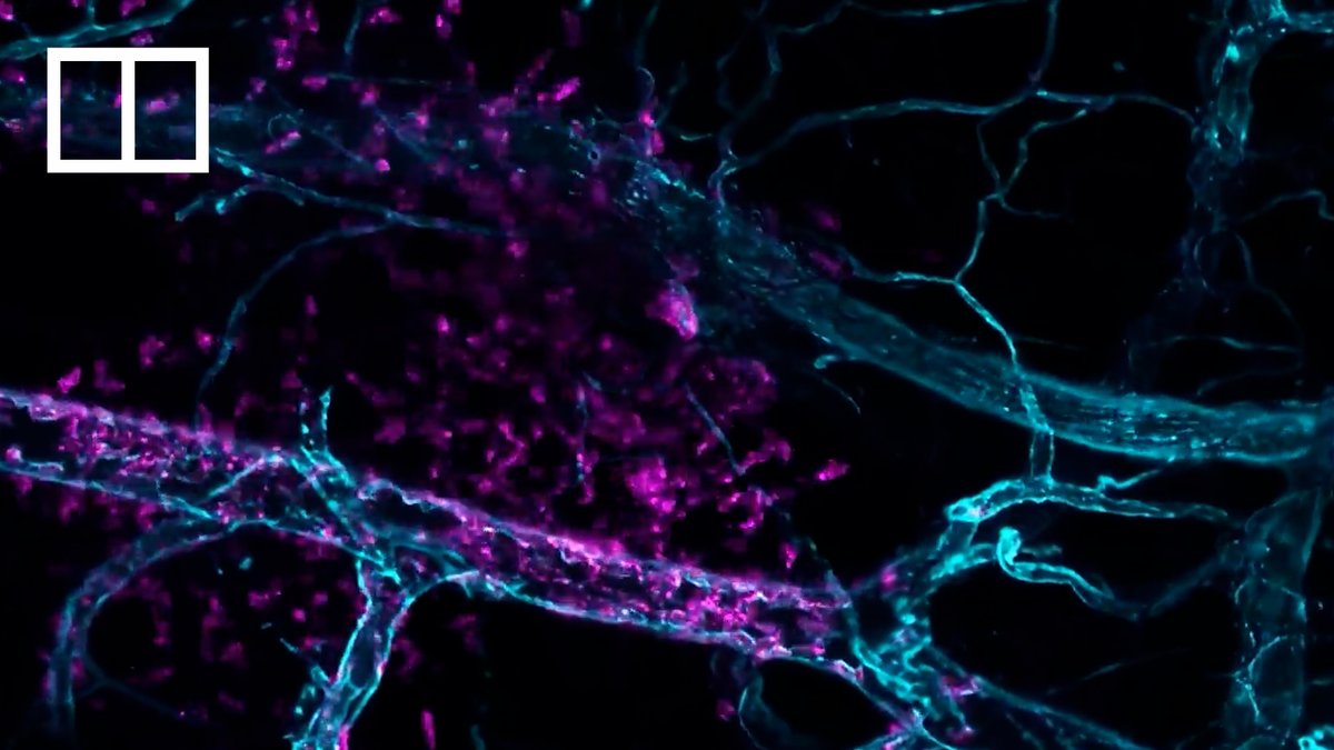 A cutting-edge microscope has allowed scientists to capture in real time how electroacupuncture directs the movement of immune cells inside living mice for the first time.