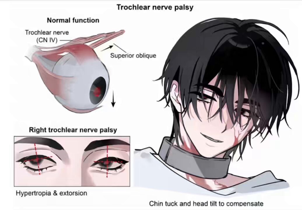 #ZOMST #ALNST #ivan 记得活动眼珠^ ^ 感觉很合适所以做了，等待第二集ivti的回合