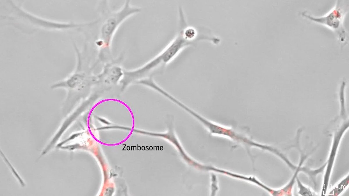 When key “housekeeper” brain cells grow in lab dishes, they spawn unusual microscopic vesicles that can move on their own and carry energy-generating organelles, a research team revealed earlier this year. The biologists have dubbed their discovery zombosomes because the blobs can move like cells for a period despite lacking a nucleus, which acts as a cell's control center. The group also showed the membrane-bound messengers ferry proteins related to Parkinson’s disease, suggesting they may contribute to it and other brain disorders. Learn more on #WorldBrainDay: