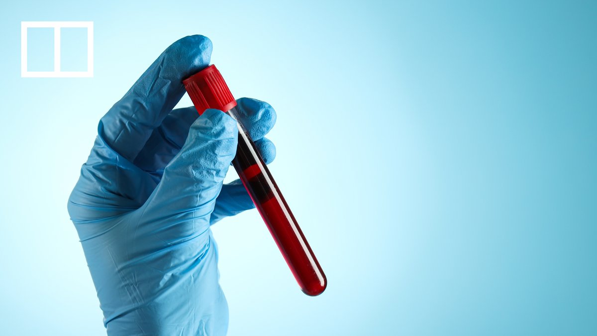 Hong Kong researchers say they are developing a more affordable and less invasive method to confirm cancer, with the aim of having fewer patients undergo painful biopsies.