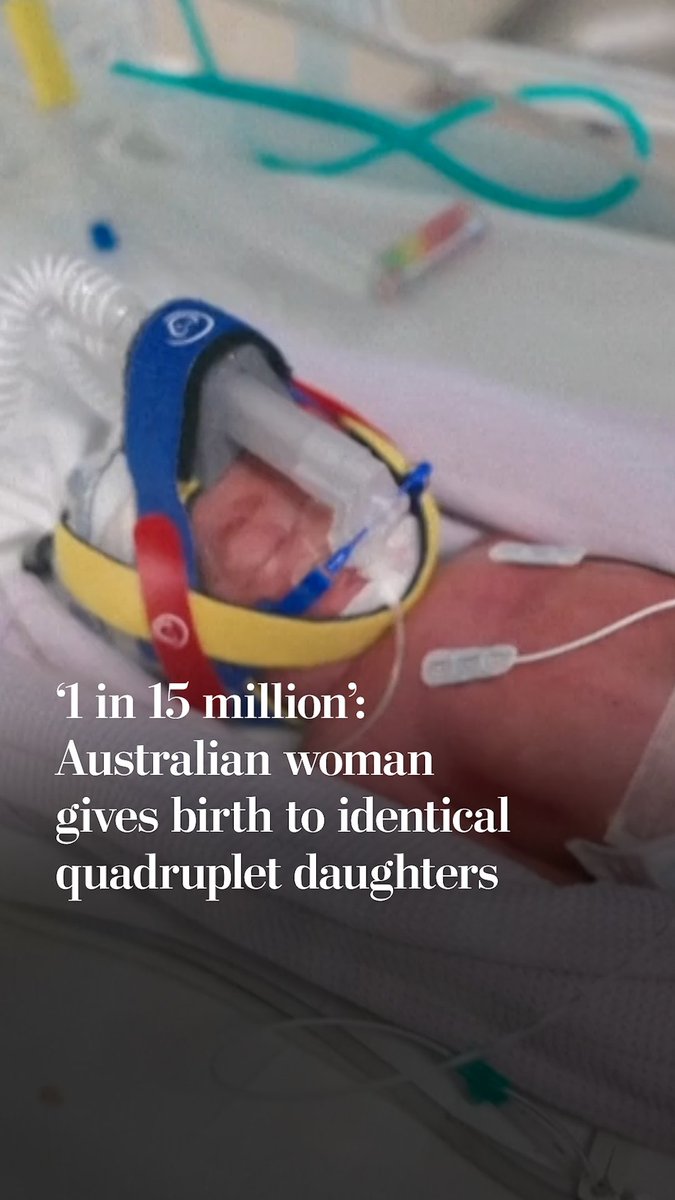 An Australian woman gave birth to identical quadruplet girls last week. The chance of conceiving monozygotic quadruplets is 1 in 15 million, said Alexa Bendall, a maternal fetal specialist.