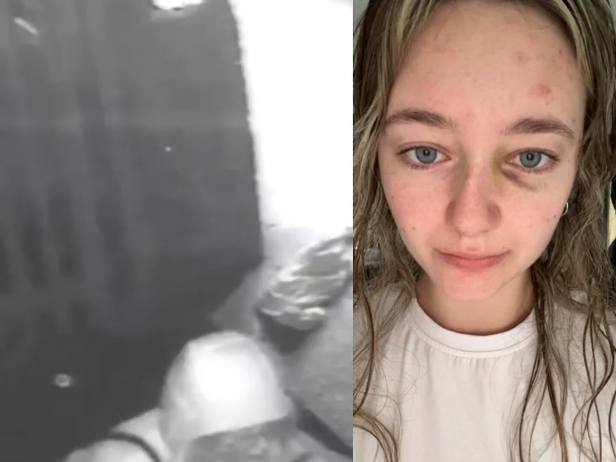 🚨BREAKING: Illegal immigrant who knocked out 20 year old girl on camera given just MONTHS in prison Cloe Lake was walking home after a night out in Bournemouth with some friends when Abdoela Berhan, a 35 year old failed asylum seeker from Eritrea who should have been deported but wasn't, followed her home He harassed her, begged her for attention and wanted sex. She said no repeatedly before telling him to "F**K OFF" In response he punched her completely out cold and left her in a "bloody mess" Just one week earlier he had been convicted of assaulting a worker in Subway but once again a violent foreign thug was free to roam the streets despite being a convicted criminal Today he was sentenced to just SIX MONTHS in prison Absolutely disgusting There is no justice in the UK We are going through a migrant violence epidemic against women and children This is not a safe country anymore