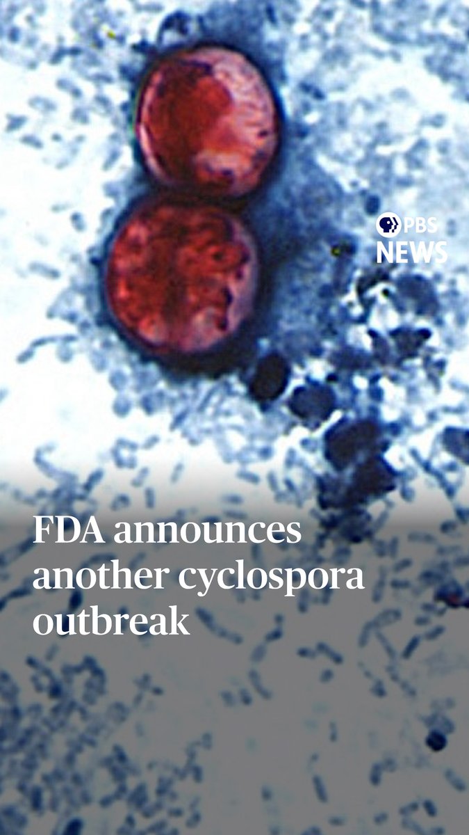 The FDA just announced there’s another cyclospora outbreak. Seventy-two people have been linked to the new outbreak, according to an update posted on the agency’s website Wednesday. While the agency has launched traceback investigations, it has not provided any information on the source of the parasite or the outbreak location. Messaging around these outbreaks has been confusing and health experts say that’s in part because of the difficulty in tracking the parasite, which also can’t be reproduced in a lab. The previous major outbreak, focused in Michigan and four surrounding states, has been linked to shredded iceberg lettuce sold by Taylor Farms and grown in central Mexico, though that’s not been confirmed through lab testing. On Friday, the Washington Post reported that the Centers for Disease Control and Prevention has linked this outbreak to four additional states — Illinois, Kansas, Oklahoma and Pennsylvania — bringing the total to nine. Meanwhile, individual cases of cyclosporiasis have now been reported in 41 states. While we wait for more information, these are still good food safety tips to follow: Wash hands with soap and water before handling food. Alcohol-based sanitizers don’t kill cyclospora, but soap and water is highly effective. Make sure to wash your produce well and cook food to at least 158 degrees Fahrenheit. Lastly, stay away from recalled produce and wash surfaces that it may have touched.