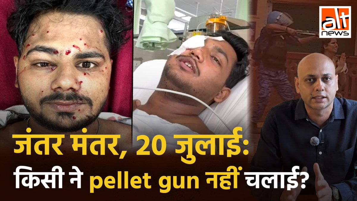 दिल्ली में छात्रों के प्रदर्शन के बीच पैलेट गन के पीड़ितो की तस्वीरें सामने आयी. 3 में से एक पीड़ित के एक आँख की रोशनी जा सकती है वहीं 1 पैलेट गन विक्टिम आउट्लुक के पत्रकार हैं. फिर भी प्रशासन दावा करता रहा कि पैलेट गन नहीं चलाई गई थी. देखिये ये रिपोर्ट