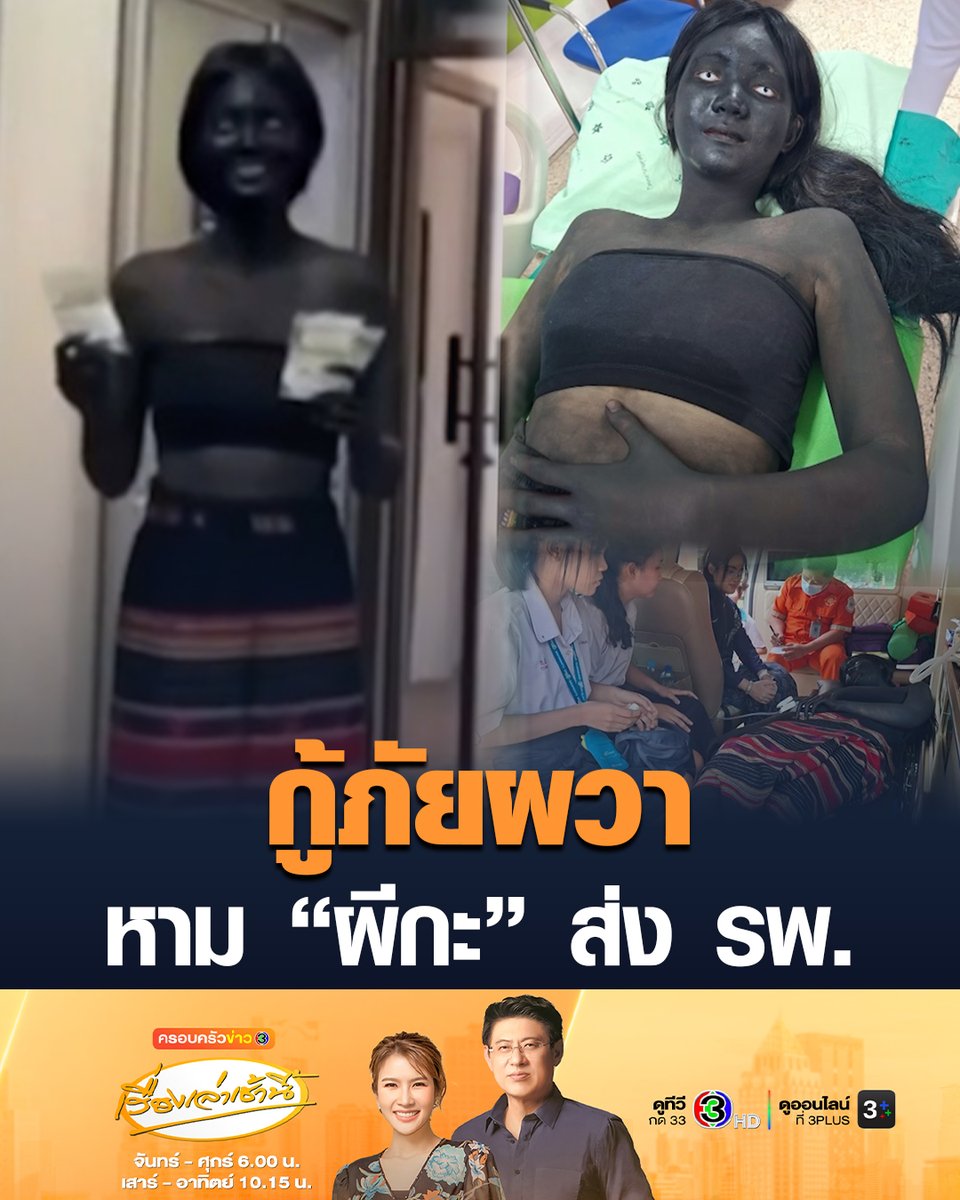 #เรื่องเล่าเช้านี้ ไวรัลหาม “ผีกะ” ส่ง รพ. กู้ภัยยโสธรแชร์ภาพ สาวพอกตัวด้วยสีดำจนตัวดำปี๋ เหลือแต่ตาขาวโพลนนอนบนรถเข็น ทำเอาแอบตกใจกันทั้ง รพ. ก่อนเฉลยว่า สาวแต่งตัวเป็นผีกะ แสดงละครงานวันสุนทรภู่และวันภาษาไทย ล่าสุดหายป่วย รับยากลับบ้านแล้ว #ข่าวช่อง3 #กู้ภัย #ผีกะ #ยโสธร