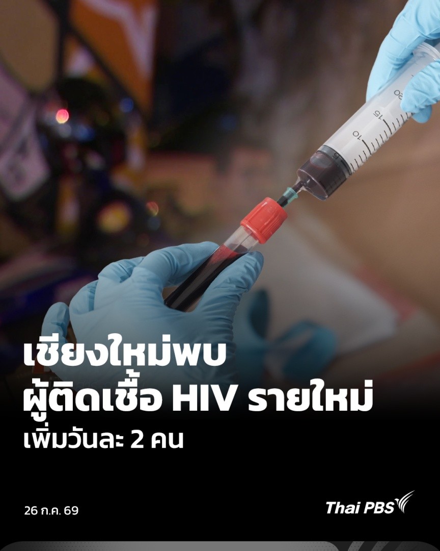 จ.เชียงใหม่ ล่าสุดมีผู้ติดเชื้อ HIV สะสม 23,900 คน เป็นผู้ติดเชื้อรายใหม่ 700 คน หรือพบเพิ่มวันละ 2 คน โดยนอกจากกลุ่มเยาวชน และวัยทำงานแล้ว แรงงานข้ามชาติ และกลุ่มชาติพันธุ์ ก็มีอัตราการติดเชื้อ HIV และโรคติดต่อทางเพศสัมพันธ์สูงกว่ากลุ่มอื่น #ข่าวเที่ยง #ThaiPBS