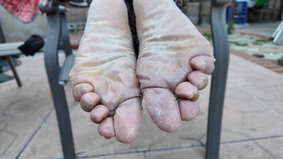 Mom just dropped her sandals and is waiting for you to pick them up, but while doing so you look up and she happens to rest her Dry smelly feet right on your lips. What are you doing next?