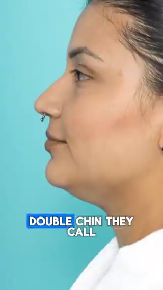 A double chin often develops from loose skin and weak fascia, which is the connective tissue beneath your skin that supports your muscles. As we age, the fascia and muscles under the neck aren't used as much, which leads to sagging. Each of these exercises targets a different layer of fascia and muscle to stretch, strengthen, and tone the neck area. Do each exercise for 30 seconds on a regular basis to see noticeable improvement. Dr. Eric Berg, DC, not MD; information only