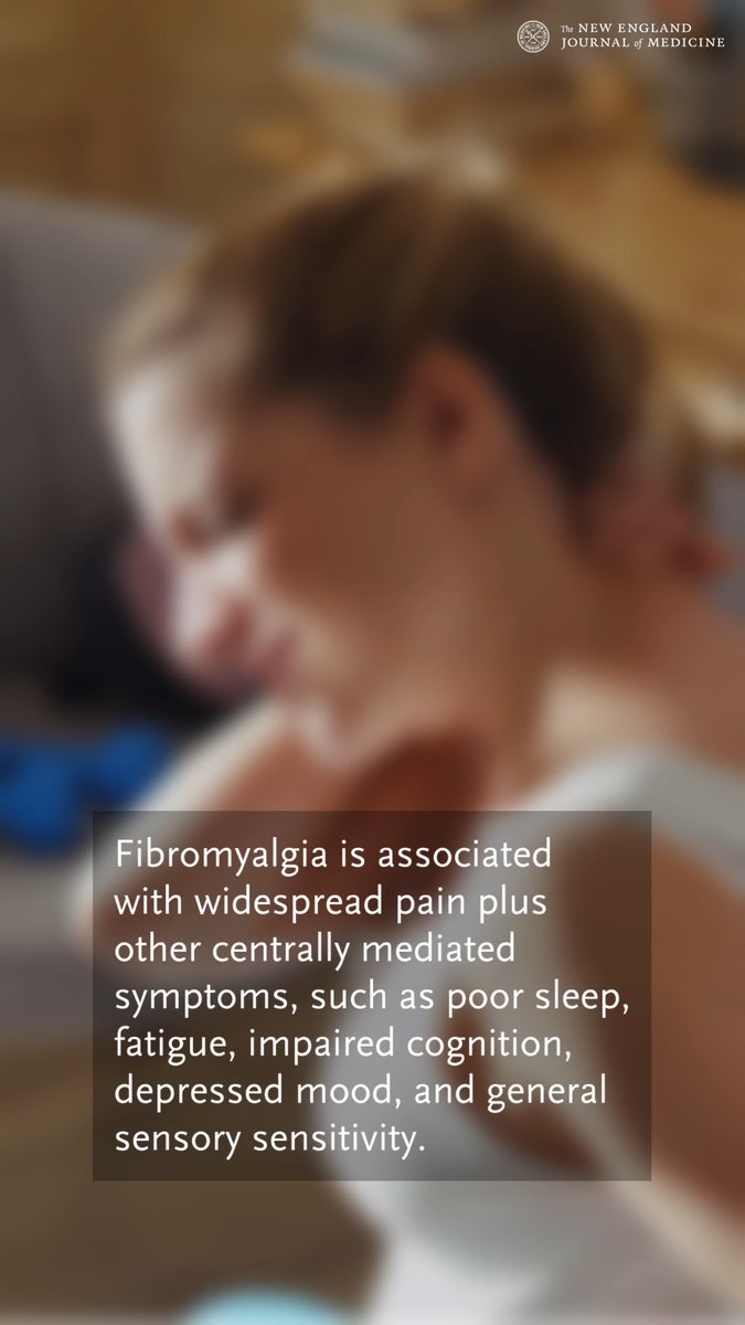 Fibromyalgia is associated with widespread pain, sleep difficulty, fatigue, and cognitive symptoms. Treatment includes education and nonpharmacologic interventions; selected drugs may help, but opioid agents are not recommended. Learn more: