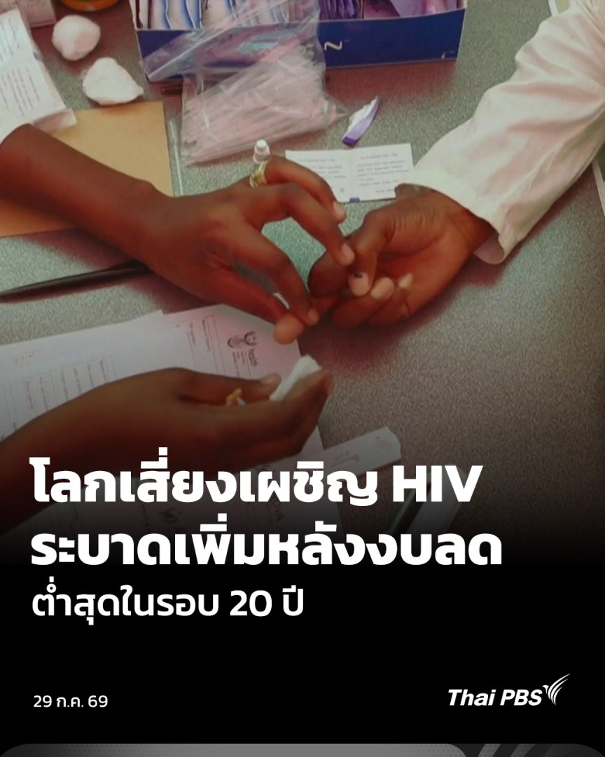 ผู้เชี่ยวชาญจากโครงการเอดส์แห่งสหประชาชาติ (UNAIDS) เตือน โลกเสี่ยงจะเผชิญการแพร่ระบาดอย่างหนักของไวรัส HIV และโรคเอดส์รอบใหม่ หลังเงินช่วยเหลือระดับนานาชาติ สำหรับต่อสู้กับโรคเอดส์ลดลงราว 18% ในช่วงปีที่ผ่านมา จนอยู่ในระดับต่ำที่สุดในรอบเกือบ 20 ปี #วันใหม่ไทยพีบีเอส #ThaiPBS