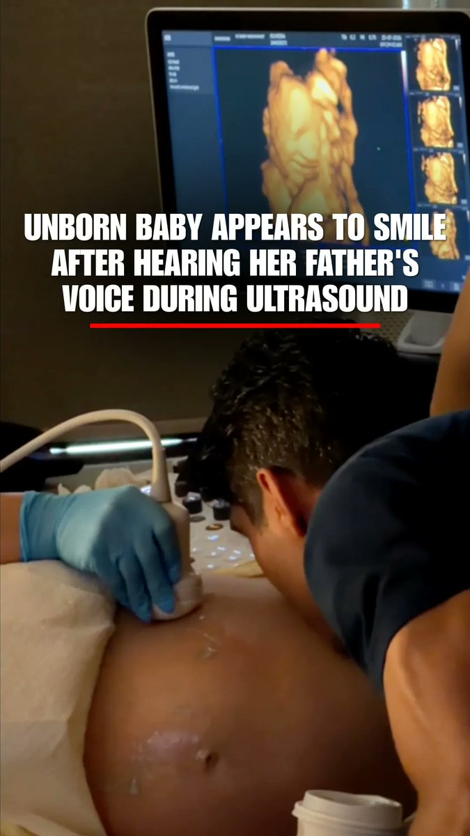 An unborn baby girl appears to smile the moment she hears her father's voice during an ultrasound. The sweet moment was caught on video as the dad spoke to his daughter and kissed her mother's belly, prompting smiles from everyone in the room. "I was completely overwhelmed with emotion and immediately started crying happy tears," mom Lia Oliveira said. She called it a "core memory" for their family and says she's grateful the moment has brought "a little sunshine" to millions of people around the world.
