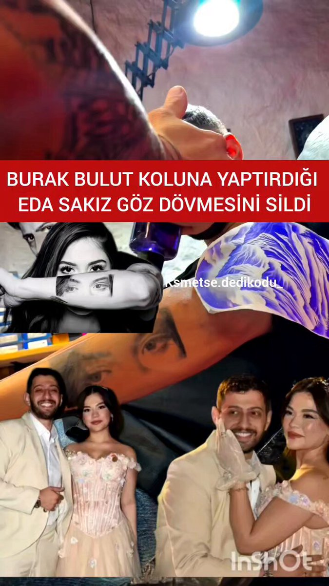 ŞOK ŞOK ŞOK Burak bulut Boşandığı eski Eşi Eda Sakızın gözlerini yaptırdığı dövmesini sildirdi Burak Bulut ve Eda Sakız çifti 12 Ağustos 2025 tarihinde evlenmiş, yaklaşık 9 ay süren evliliklerinin ardından Mayıs 2026'da tek celsede boşanmışlardı çalan şarkıyıda edaya yazmış