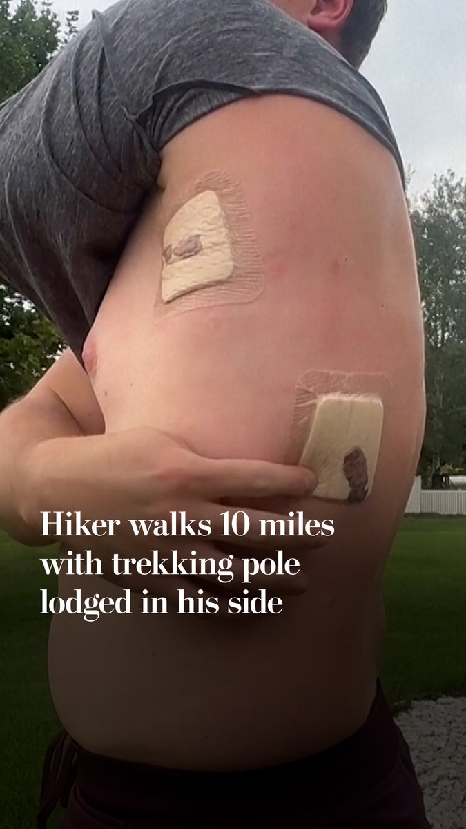 A Montana hiker is recovering after being impaled by his trekking pole while climbing Granite Peak, the state’s highest mountain. David Cifaldi was about three miles from the summit when he slipped and fell, leaving the steel-tipped pole lodged in his side.