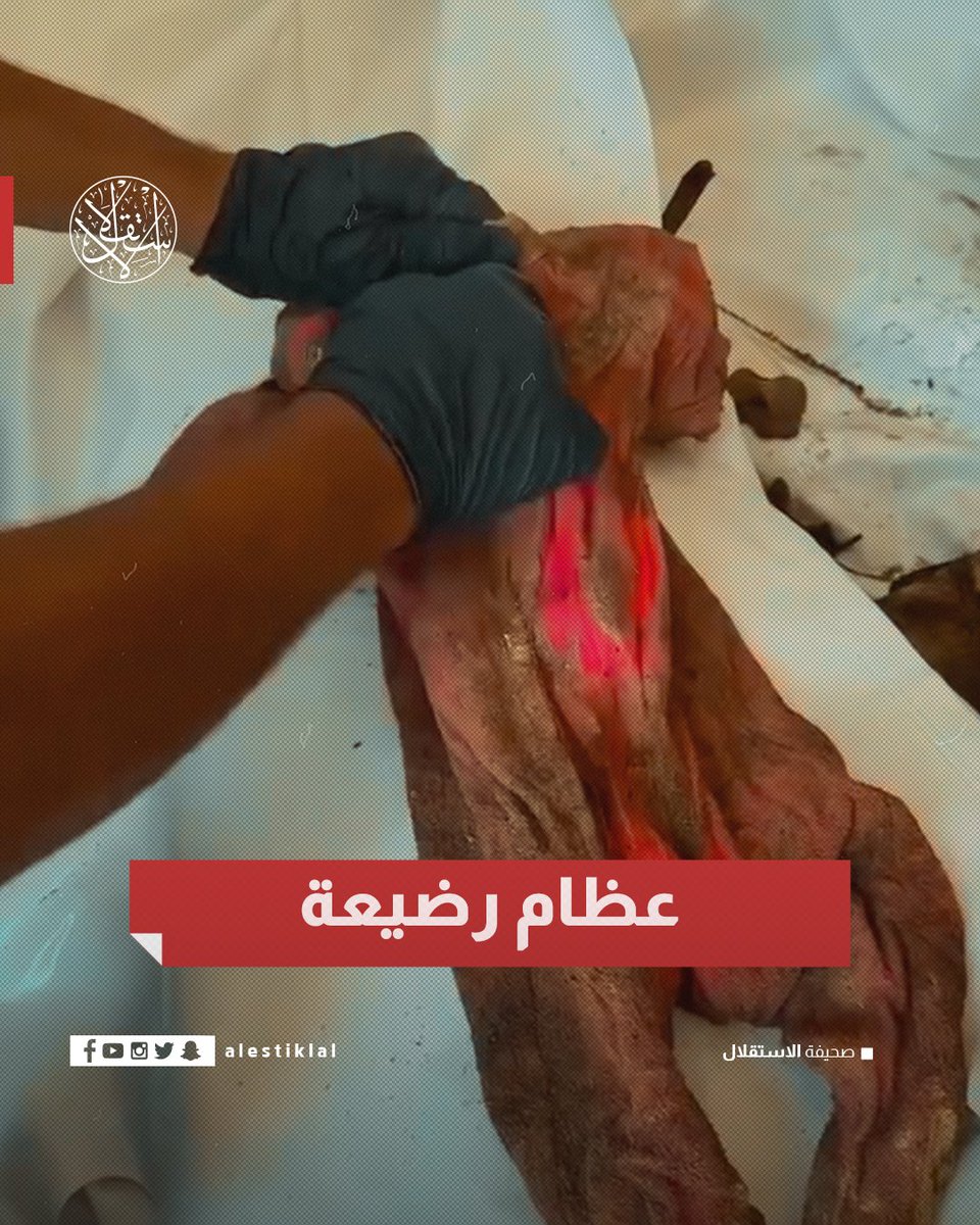 عظام صغيرة داخل ملابس رضيعة وحفاضتها ما تزال في مكانها بعد نحو ثلاث سنوات