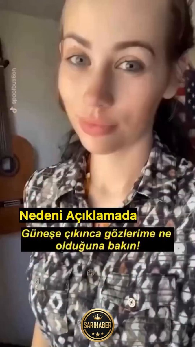 🔸Mavi gözlü bir kadın güneşe çıktığı zaman gözlerinde meydana gelen inanılmaz değişimi gösterdi.
