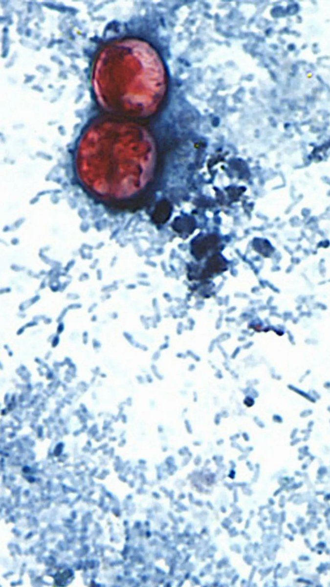 Two people have died in the cyclospora outbreak in Michigan, state health officials announced Monday, the first deaths confirmed in the U.S. related to the microscopic parasite.