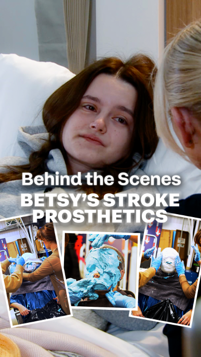 There are a lot of moving parts involved in each storyline. Here is a quick look behind the scenes of the makeup and prosthetics created for Betsy's stroke. We're proud to have such a talented team both on and off-screen ๐ฅนโค๏ธ For support and advice surrounding this storyline, please visit #Corrie
