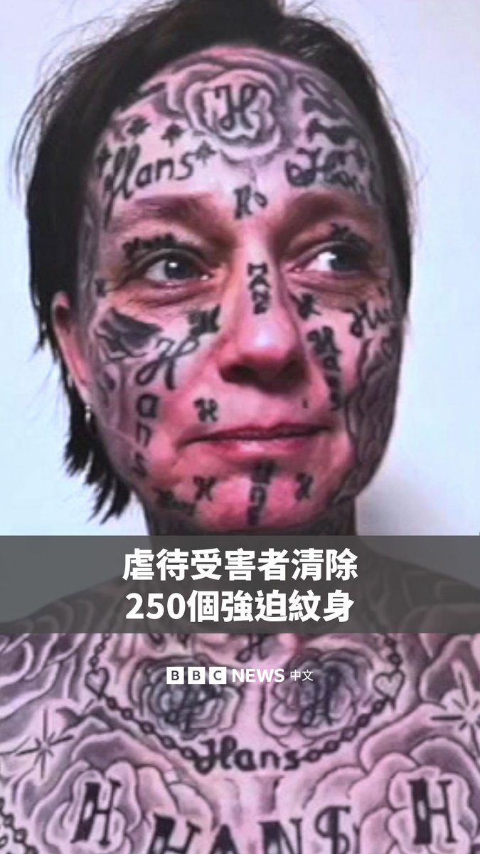 Joke多年来遭受前伴侣的虐待，甚至在家中被迫进行纹身，直到她几乎全身都布满纹身，几乎没有任何一处皮肤幸免。 前伴侣甚至在她脸上纹了自己的名字十多次，还在她的额头、鼻子、脸颊、下巴及眼皮上纹身。 在一家基金会的协助下，现年53岁的Joke历经两年半的时间、接受了12次激光疗程，才逐步去除脸上的纹身。