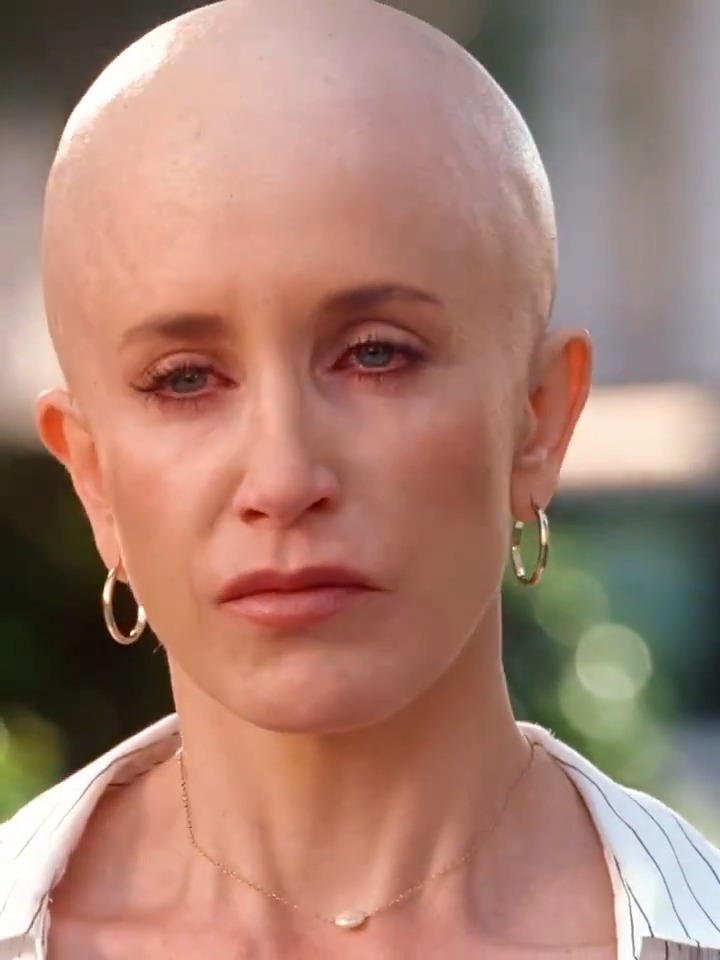 The moment Lynette Scavo stopped hiding. 😭 "I can deal with the chemo, but what I cannot deal with is the pity." 💔 Lynette ripping off her wig to stop the nagging is still one of the most powerful and raw moments on Desperate Housewives.